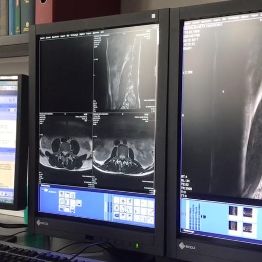 Our MRI Scan Results - 2017